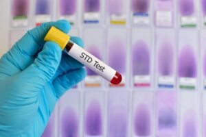 Yeast Infection Vs STD
